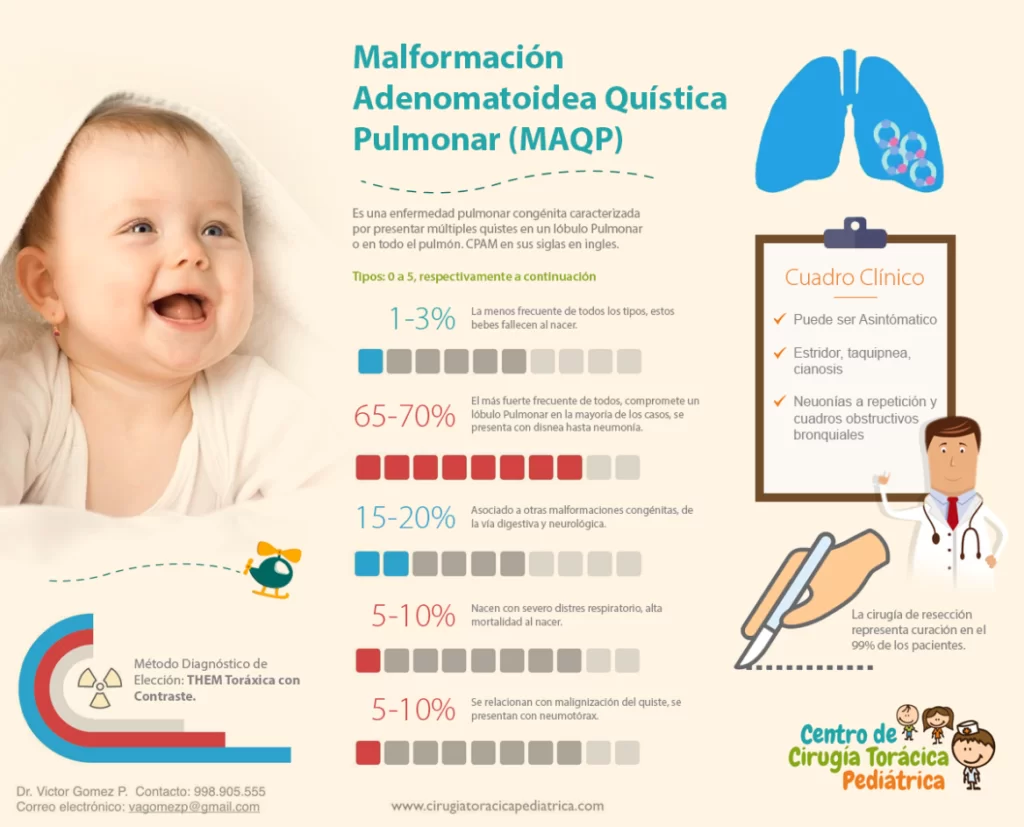 Malformaciones Pulmonares Congénitas